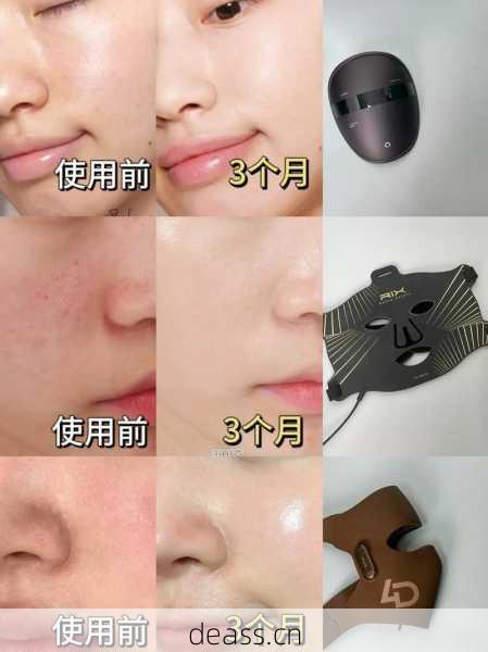 面膜仪面罩维修视频哪里有完整版？(快速学会修复小技巧)
