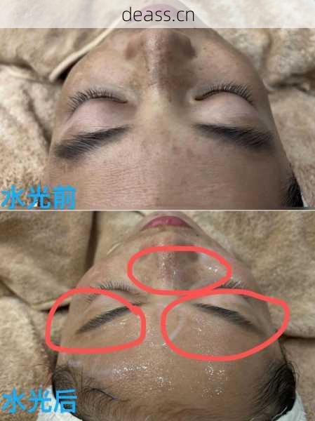 美容水光枪维修视频教程效果如何？用户分享实用修复经验！