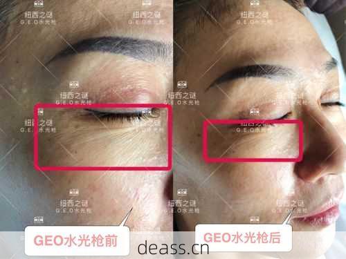 水光枪显示屏维修哪家好?实地对比三家维修店